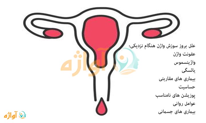 علل سوزش واژن هنگام نزدیکی