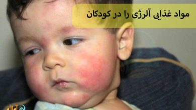 مواد غذایی آلرژی را در کودکان