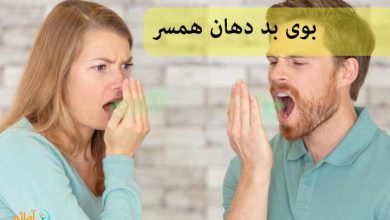 بوی بد دهان همسر